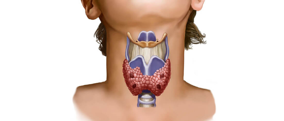 Спирает в зобу. Гипоплазия щитовидной железы. Щитовидная железа у женщин. Гортань и щитовидная железа.