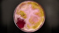 Бактерии в моче